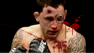 frankie - MyMMANews Frankie Edgar zombie