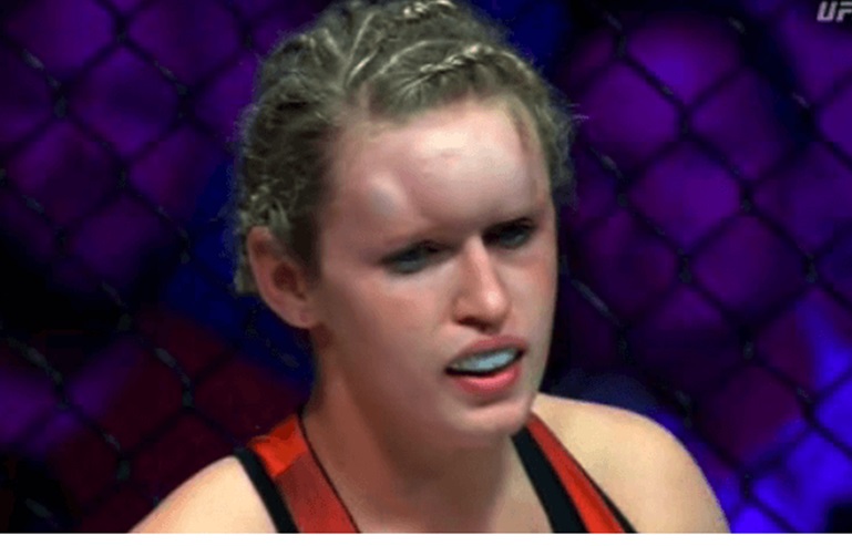 Rachel Wiley's hematoma during fight with Felicia Spencer at Invicta FC 14