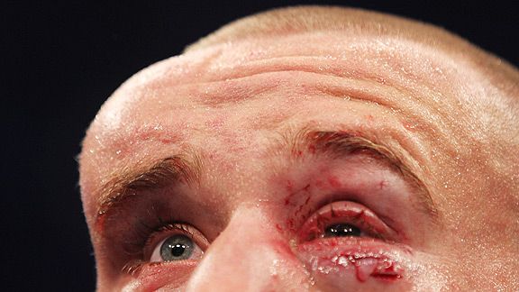 Mark Hominick's head swells massively during UFC 129 bout with Jose Aldo.