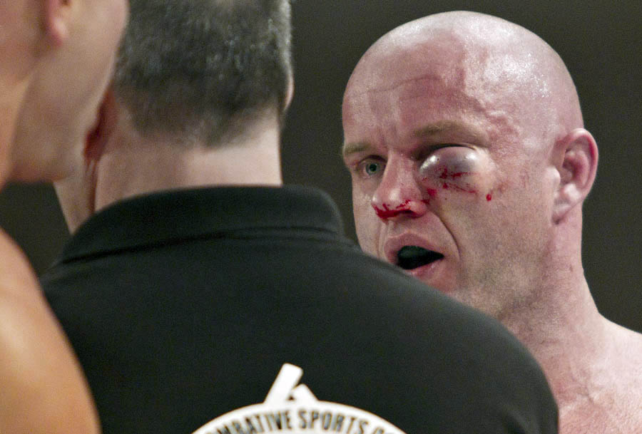 EDMONTON, AB: FEBRUARY 25, 2011Dwayne Lewis talks with the ref after the fight was stopped due to the swelling on his eye after fighting Ryan Jimmo during the main card at MFC Supremacy 28 at the River Cree Resort and Casino February 25, 2011. Ryan Jimmo won the fight. (Jason Franson Edmonton Journal.) For Paul Cashman.