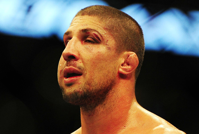 Brendan Schaub's jaw after fight with Andrei Arlovski