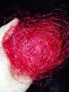 Racheal Blaze holds a patch of red hair that fell from her head.