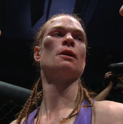 Peggy Morgan's cheek bone swells during a fight with Irene Aldana at Invicta FC 8.
